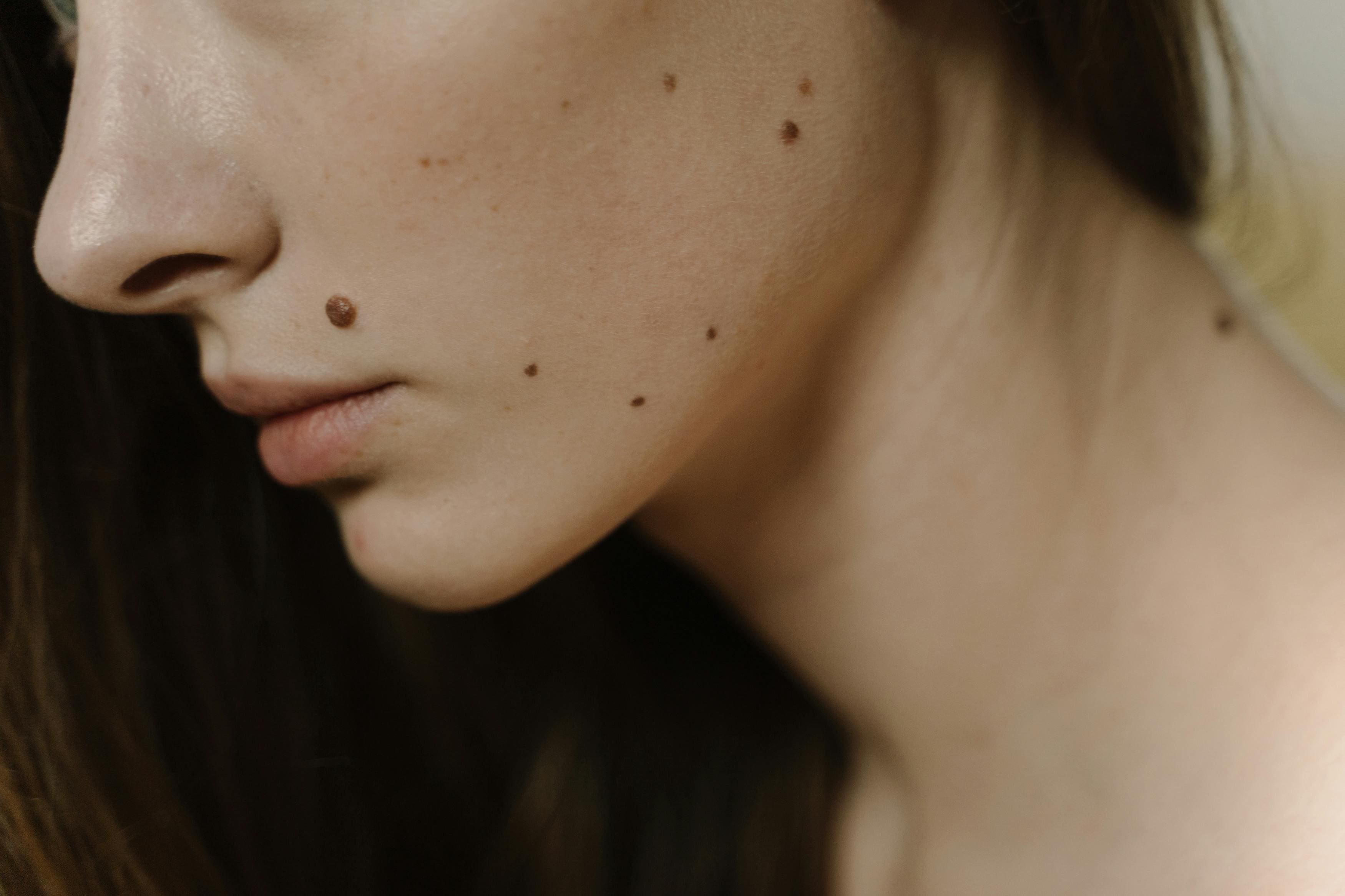 ¿Dónde puedo encontrar un dermatólogo cerca de mí en Madrid?
